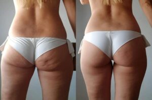 Review image for 169