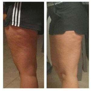 Review image for 169