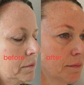 Review image for 186