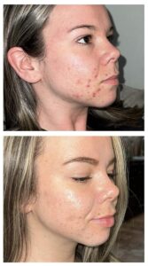 Review image for 105