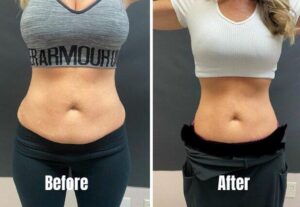 Review image for 169