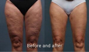 Review image for 169