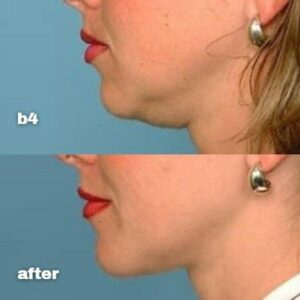 Review image for 186