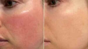 Review image for 126